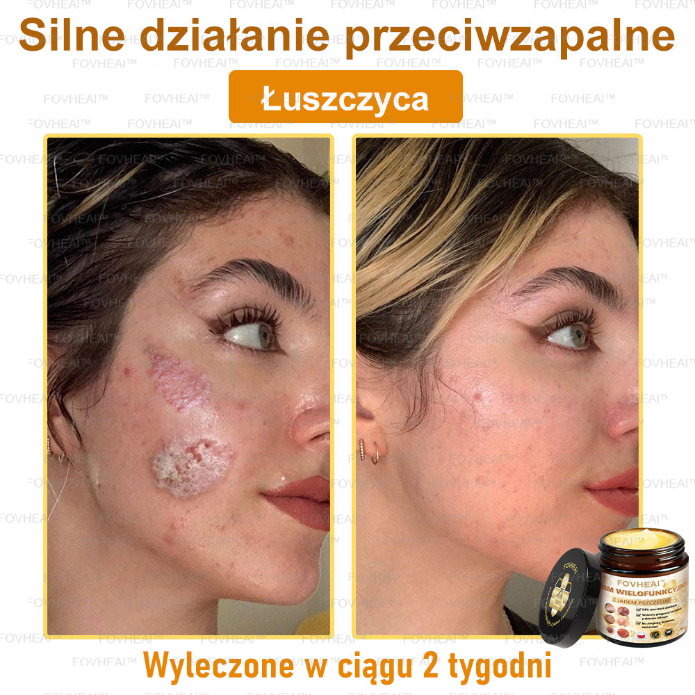 💎💎FOVHEAl™ Krem wielofunkcyjny z jadem pszczelim - Polecane przez dermatologów – Odpowiednie dla każdego wieku