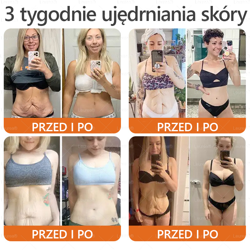 ✨Leurea® Krem Regenerujący z Jadem Pszczelim🔥 Naturalna regeneracja skóry, wygładzenie zmarszczek i promienna cera-50 ml