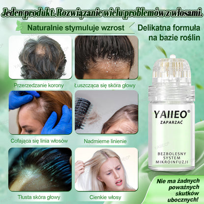 🍌 𝐘𝐀𝐈𝐈𝐄𝐎® Bezbolesny System Mikroinfuzji Głębokie blokowanie DHT, reaktywacja mieszków włosowych i widoczny wzrost włosów