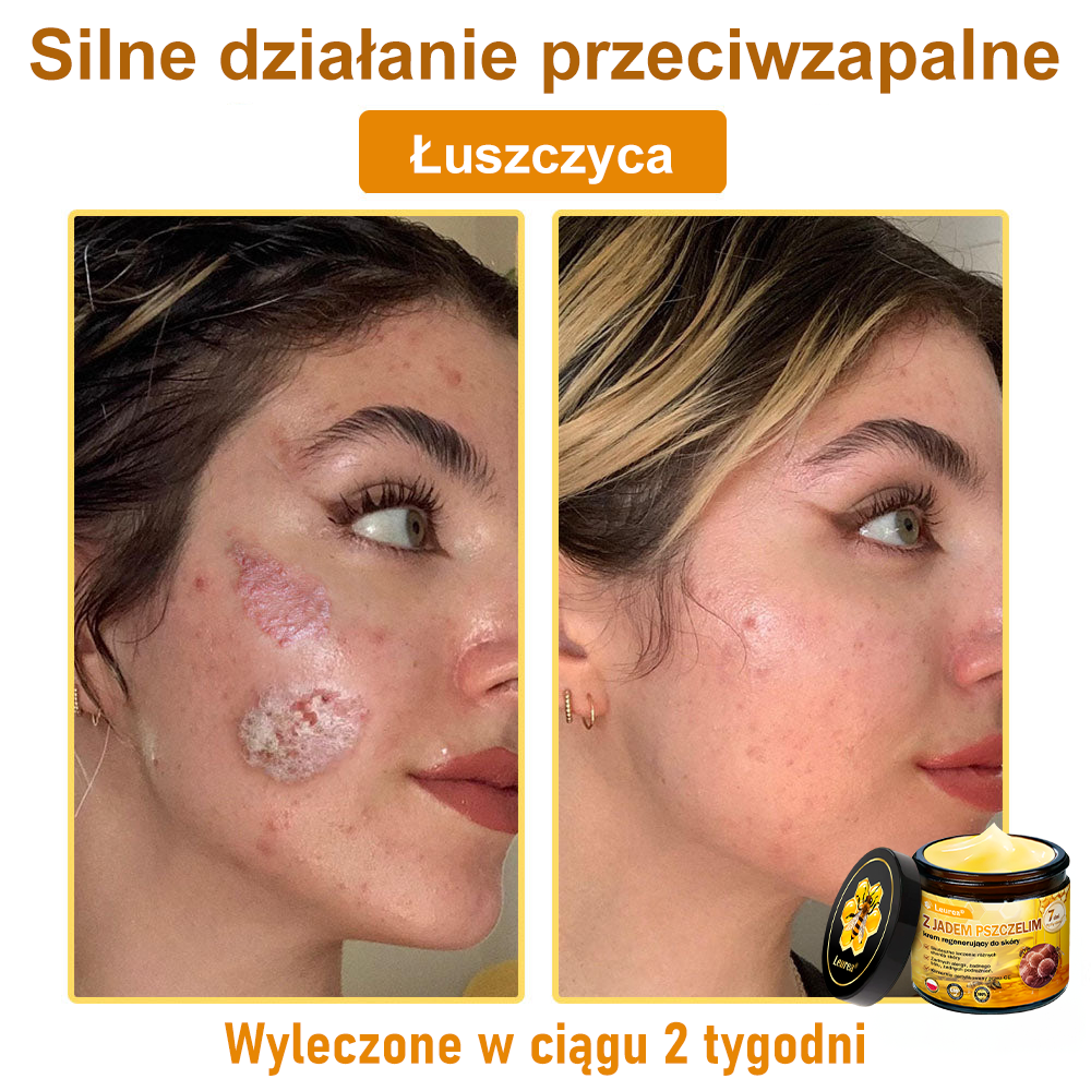 ✨Leurea® Krem Regenerujący z Jadem Pszczelim🔥 Naturalna regeneracja skóry, wygładzenie zmarszczek i promienna cera-50 ml