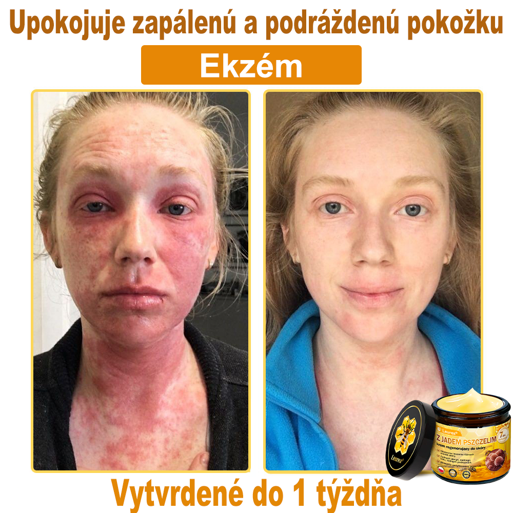 ✨Leurea® Krem Regenerujący z Jadem Pszczelim🔥 Naturalna regeneracja skóry, wygładzenie zmarszczek i promienna cera-50 ml