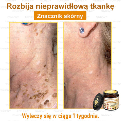 💎💎FOVHEAl™ Krem wielofunkcyjny z jadem pszczelim - Polecane przez dermatologów – Odpowiednie dla każdego wieku
