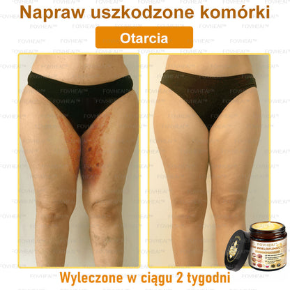 💎💎FOVHEAl™ Krem wielofunkcyjny z jadem pszczelim - Polecane przez dermatologów – Odpowiednie dla każdego wieku