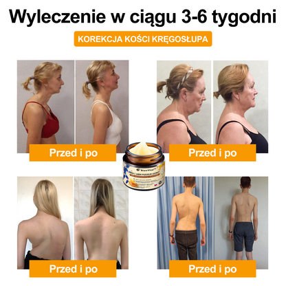 🐝𝑺𝒕𝒂𝒘𝑽𝒊𝒕𝒂𝒍™ Krem do regeneracji stawów i kości zawiera toksynę botulinową i jad pszczeli | ✨ Produkt z certyfikatem CE
