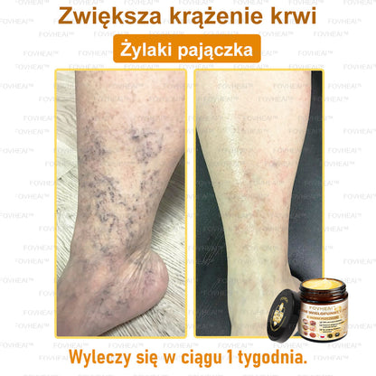💎💎FOVHEAl™ Krem wielofunkcyjny z jadem pszczelim - Polecane przez dermatologów – Odpowiednie dla każdego wieku