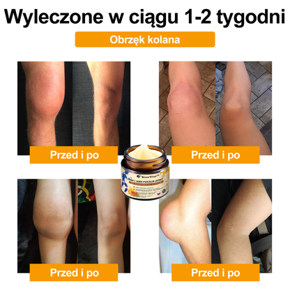 🐝𝑺𝒕𝒂𝒘𝑽𝒊𝒕𝒂𝒍™ Krem do regeneracji stawów i kości zawiera toksynę botulinową i jad pszczeli | ✨ Produkt z certyfikatem CE