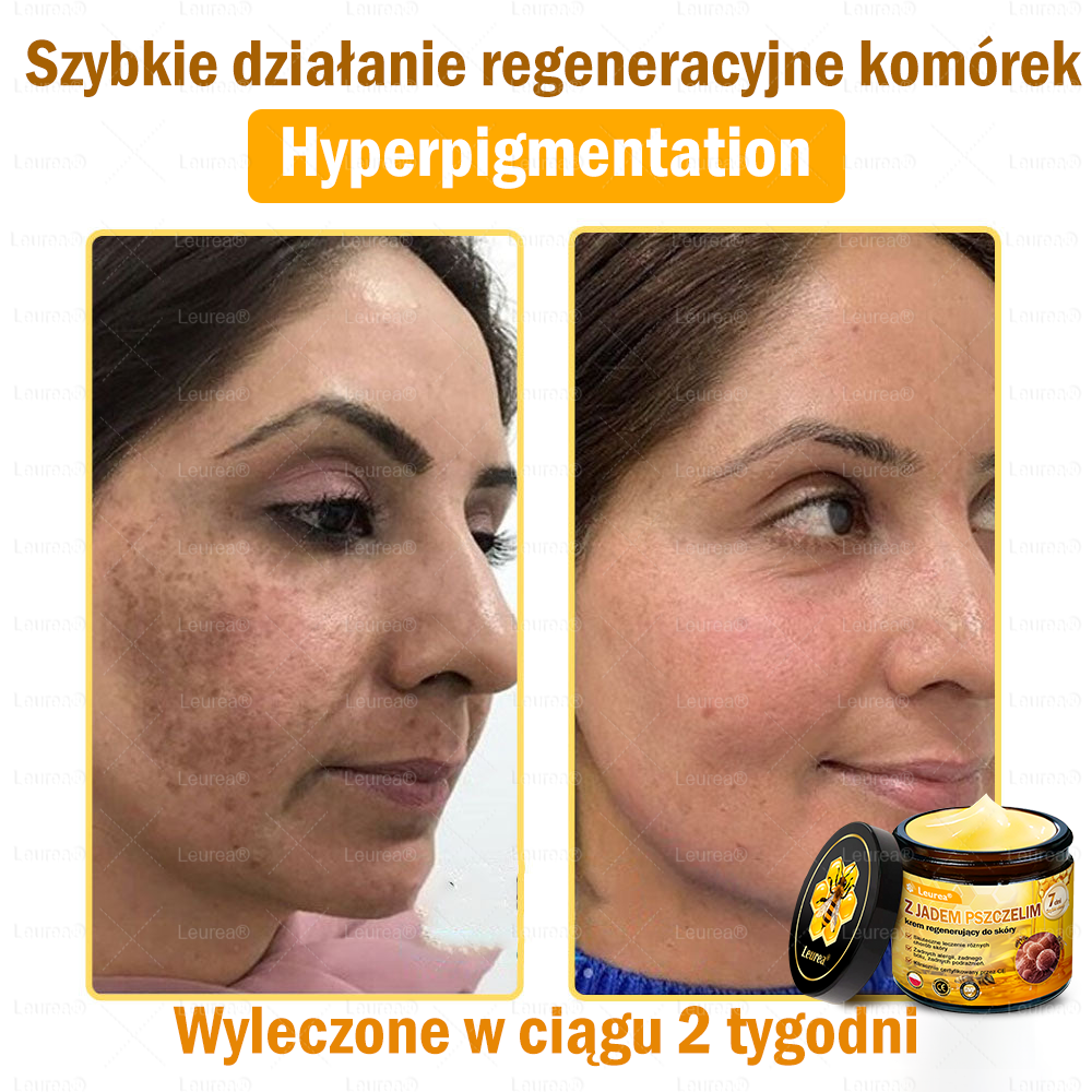 🐝✨Leurea® Krem Regenerujący z Jadem Pszczelim🔥 Naturalna regeneracja skóry, wygładzenie zmarszczek i promienna cera-50 ml