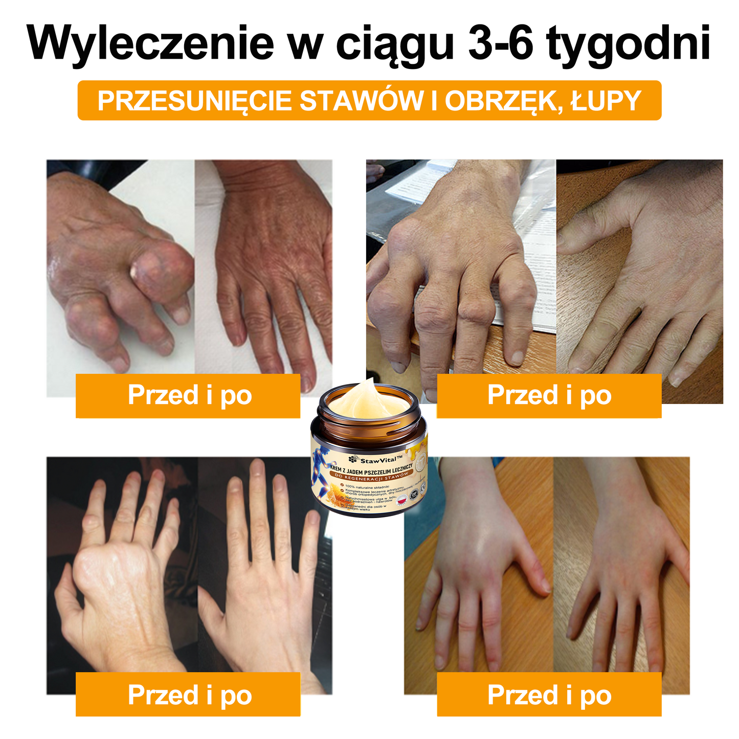 🐝𝑺𝒕𝒂𝒘𝑽𝒊𝒕𝒂𝒍™ Krem do regeneracji stawów i kości zawiera toksynę botulinową i jad pszczeli | ✨ Produkt z certyfikatem CE