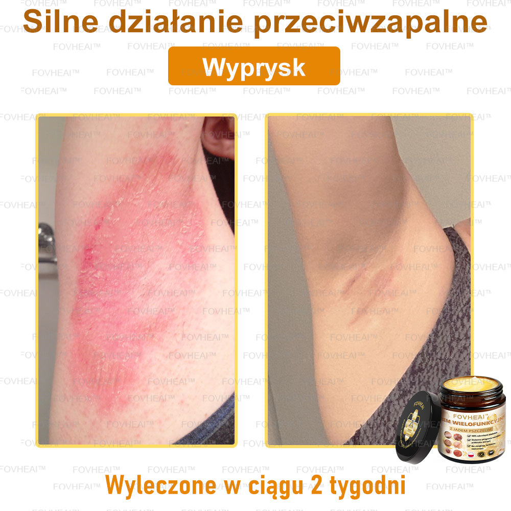 💎💎FOVHEAl™ Krem wielofunkcyjny z jadem pszczelim - Polecane przez dermatologów – Odpowiednie dla każdego wieku