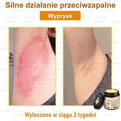 💎💎FOVHEAl™ Krem wielofunkcyjny z jadem pszczelim - Polecane przez dermatologów – Odpowiednie dla każdego wieku