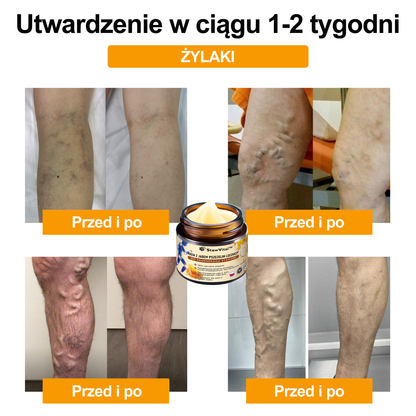🐝𝑺𝒕𝒂𝒘𝑽𝒊𝒕𝒂𝒍™ Krem do regeneracji stawów i kości zawiera toksynę botulinową i jad pszczeli | ✨ Produkt z certyfikatem CE