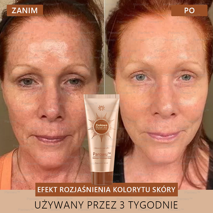💟 Parowu™ Wybielająca i Rozjaśniająca Maska - Naturalne składniki trwale usuwają plamy, piegi i przebarwienia