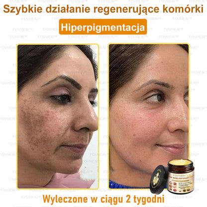 💎💎FOVHEAl™ Krem wielofunkcyjny z jadem pszczelim - Polecane przez dermatologów – Odpowiednie dla każdego wieku