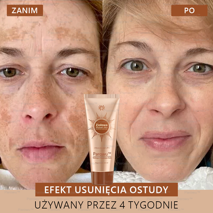 💟 Parowu™ Wybielająca i Rozjaśniająca Maska - Naturalne składniki trwale usuwają plamy, piegi i przebarwienia