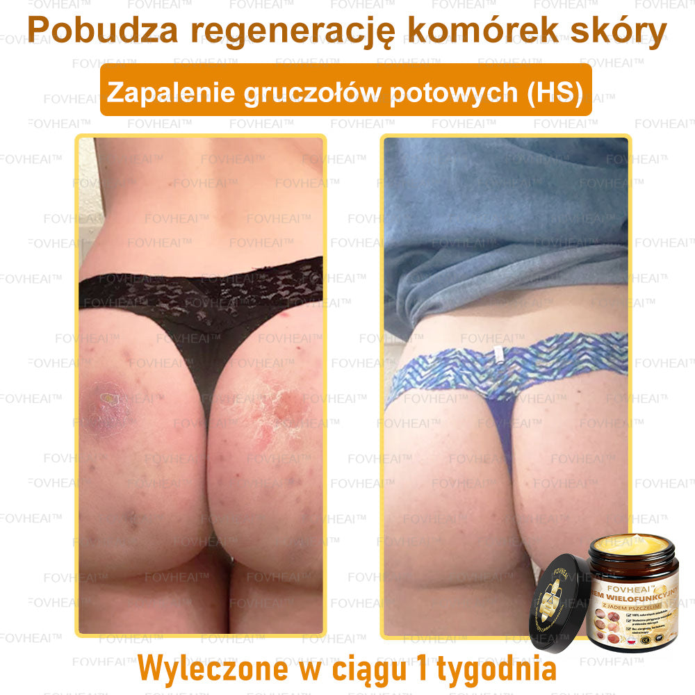 💎💎FOVHEAl™ Krem wielofunkcyjny z jadem pszczelim - Polecane przez dermatologów – Odpowiednie dla każdego wieku