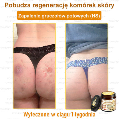 💎💎FOVHEAl™ Krem wielofunkcyjny z jadem pszczelim - Polecane przez dermatologów – Odpowiednie dla każdego wieku