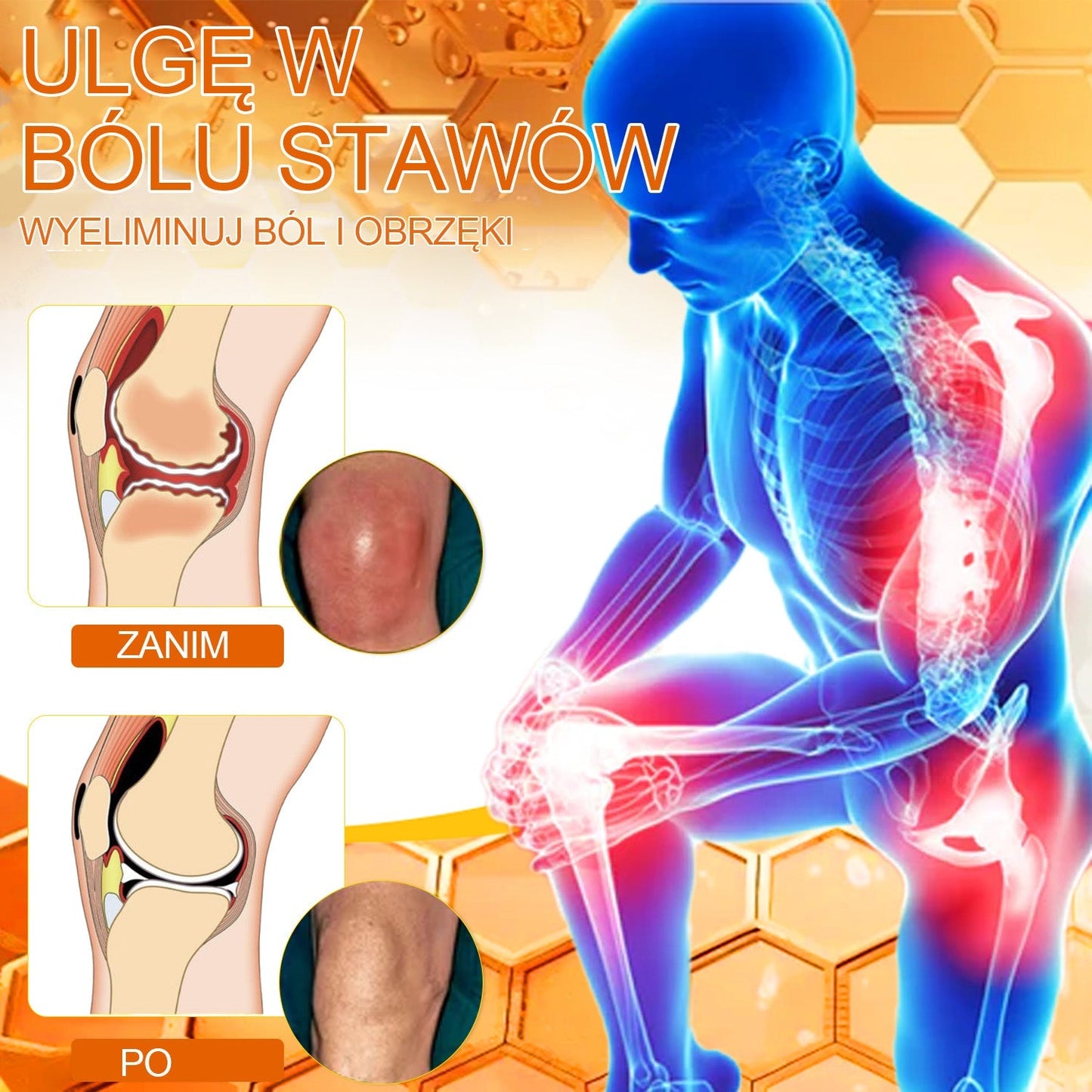 🐝𝑺𝒕𝒂𝒘𝑽𝒊𝒕𝒂𝒍™ Krem do regeneracji stawów i kości zawiera toksynę botulinową i jad pszczeli | ✨ Produkt z certyfikatem CE