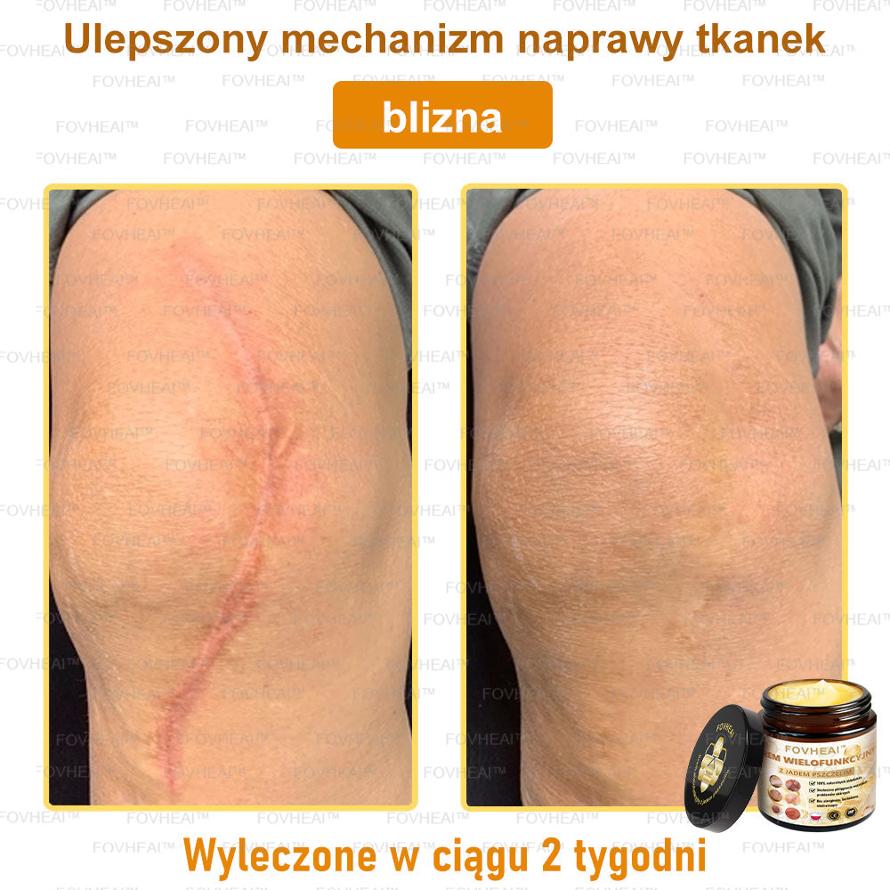 💎💎FOVHEAl™ Krem wielofunkcyjny z jadem pszczelim - Polecane przez dermatologów – Odpowiednie dla każdego wieku