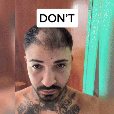 🍌 𝐘𝐀𝐈𝐈𝐄𝐎® Bezbolesny System Mikroinfuzji Głębokie blokowanie DHT, reaktywacja mieszków włosowych i widoczny wzrost włosów